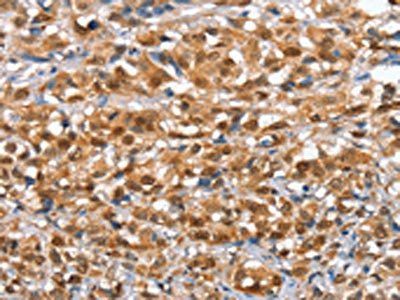 IRAK3 Antibody