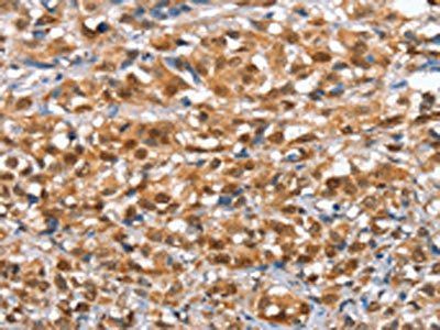 IRAK3 antibody