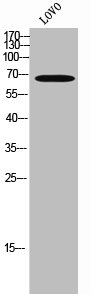 IRAK3 antibody