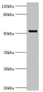 IRAK4 antibody