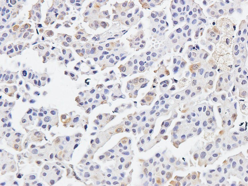 IRAK4 antibody