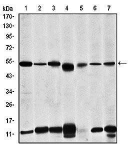 IRAK4 Antibody