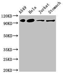 IREB2 antibody