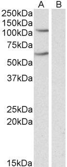 Goat anti-IREB2 / IRP2 Antibody