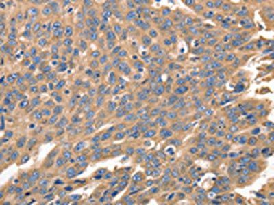 IRF1 Antibody