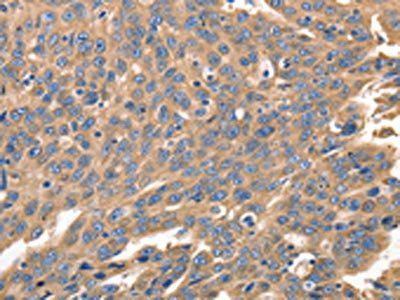 IRF1 antibody