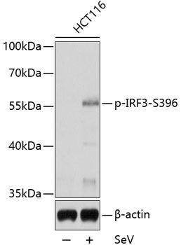 IRF3 (Phospho-S396) antibody