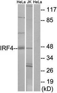 IRF4 antibody
