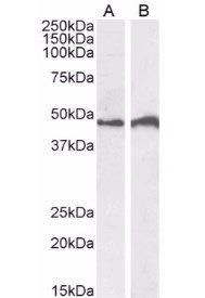 IRF4 antibody