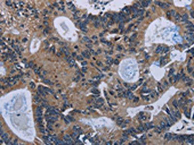 IRGM Antibody