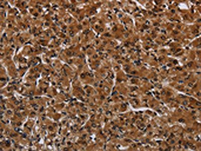 IRGM Antibody