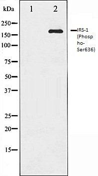IRS-1 (Phospho-Ser636) antibody