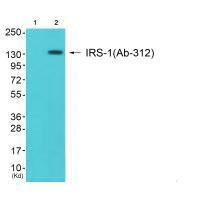 IRS1 (Ab-312) Antibody
