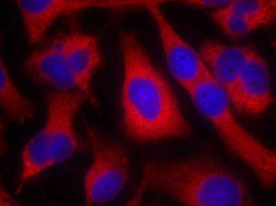 IRS1 (Ab-636) Antibody
