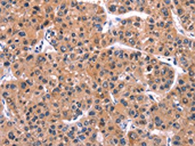 IRS1 Antibody