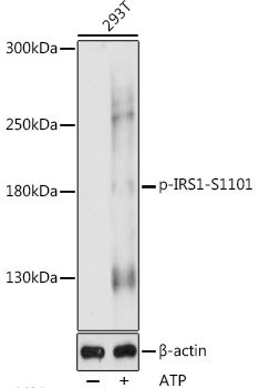 IRS1 (Phospho-S1101) antibody