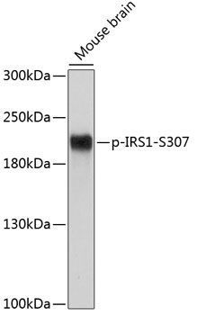 IRS1 (Phospho-S307) antibody