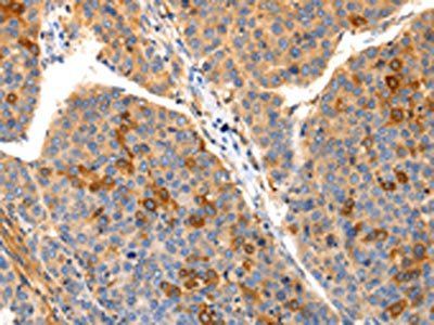 IRS2 Antibody