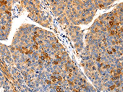 IRS2 antibody