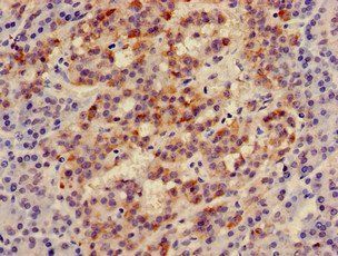 IRS2 Antibody