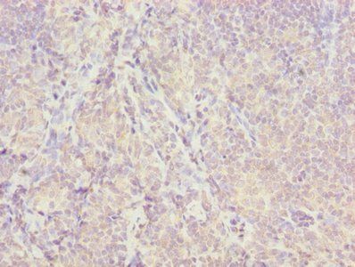 ISCA2 Antibody