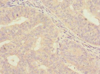 ISCU antibody