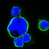 ISL1 Antibody