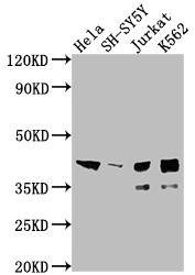 Islet 1 antibody