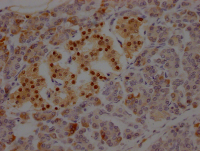 Islet 1 antibody