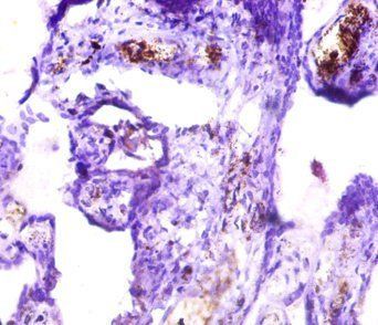ICA1 Antibody