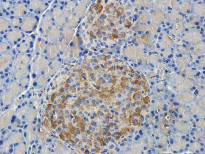 Islet 1 antibody