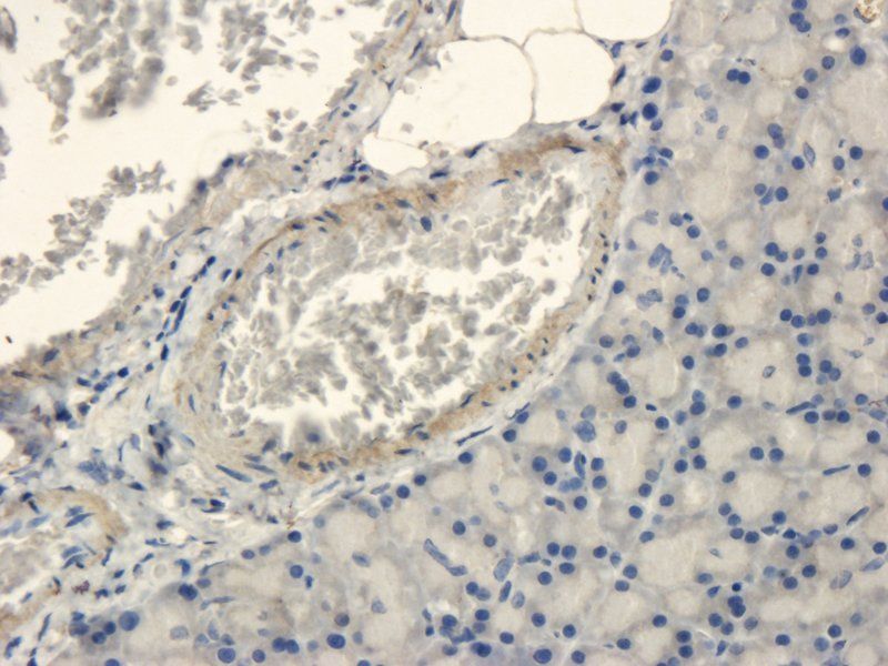 Islet 1 Rabbit Polyclonal Antibody