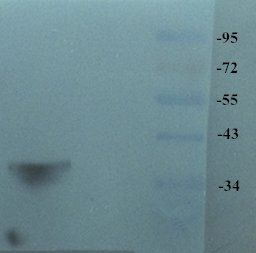 Islet 1 Rabbit Polyclonal Antibody