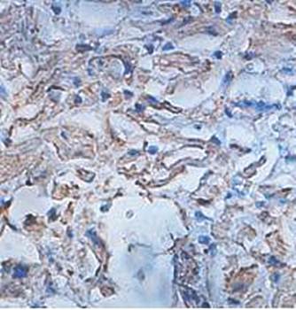 ISLR antibody