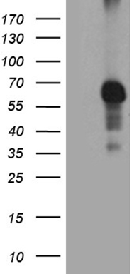 Isocitrate dehydrogenase (IDH1) antibody