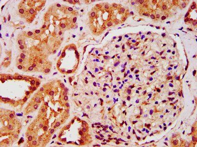 IST1 Antibody