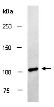 ITCH (N1) Antibody, Rabbit Polyclonal