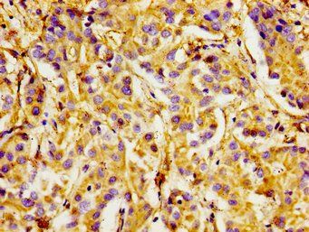 ITGA1 Antibody