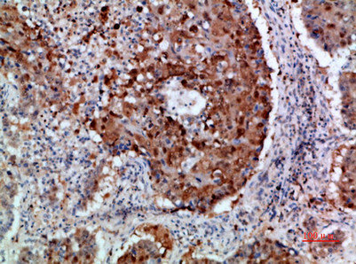 ITGA1 antibody