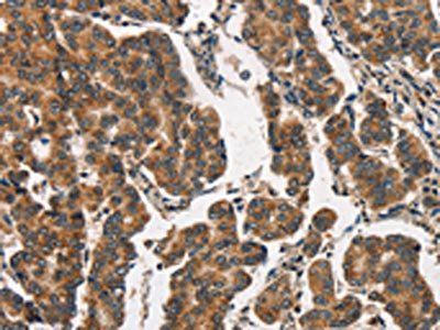 ITGA2 Antibody