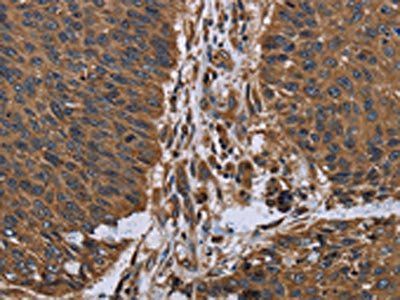 ITGA2B Antibody