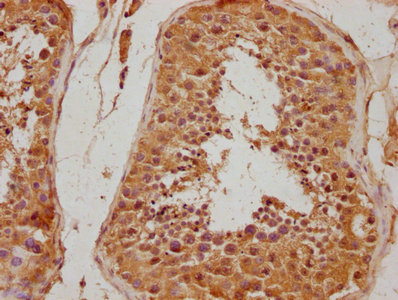 ITGA8 Antibody
