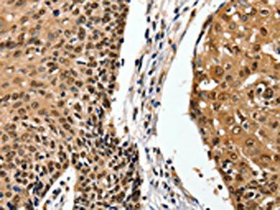 ITGAM Antibody
