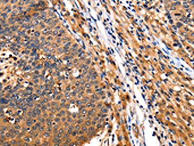 ITGAM Antibody