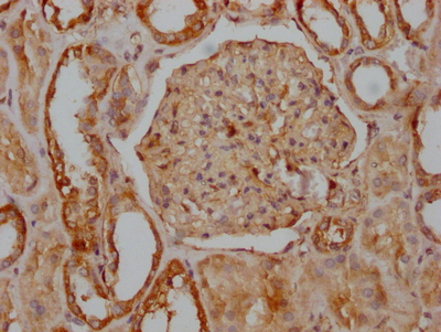 ITGAV Recombinant Monoclonal Antibody