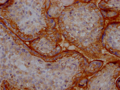 ITGAV Recombinant Monoclonal Antibody