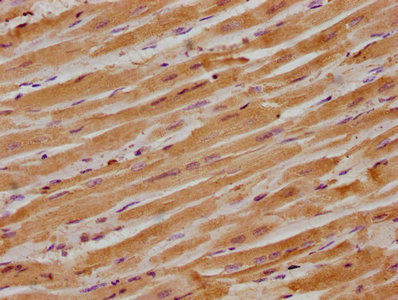 ITGB1BP1 Antibody