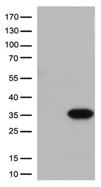 ITGB1BP3 (NMRK2) antibody