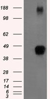 ITGB1BP3 (NMRK2) antibody
