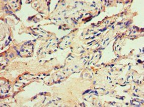 ITGB3 Antibody